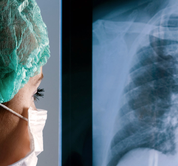 Doctor wearing face mask looking at an xray.